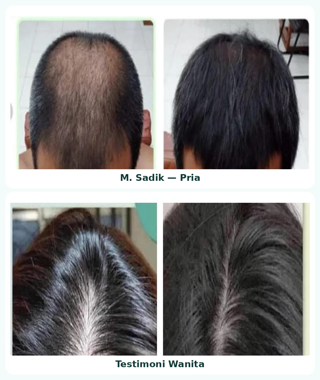 S-GLOW - Rambut Sehat Pria dan Wanita