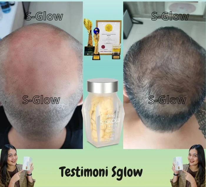 Testimoni S-GLOW