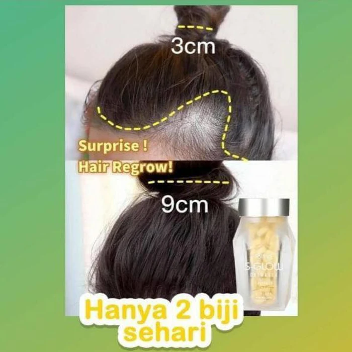 Testimoni Wanita Hair Regrow
